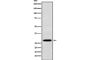 Western blot analysis of KGF expression in 293T cell lysate.