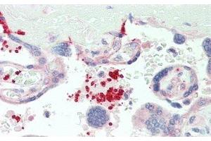 #VALUE! (CD42b anticorps  (AA 19-291))