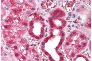 Human Kidney (formalin-fixed, paraffin-embedded) stained with ZFP36 antibody ABIN214153 at 5 ug/ml followed by biotinylated goat anti-rabbit IgG secondary antibody ABIN481713, alkaline phosphatase-streptavidin and chromogen.