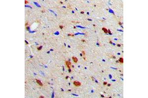 Immunohistochemical analysis of MGCRACGAP staining in human brain formalin fixed paraffin embedded tissue section.