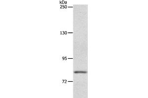 Western Blot analysis of Mouse liver tissue using ABCB6 Polyclonal Antibody at dilution of 1:250 (ABCB6 anticorps)