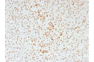 Formalin-fixed, paraffin-embedded human Pancreas stained with ATRX Mouse Monoclonal Antibody (39f). (ATRX anticorps)