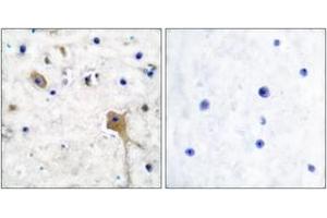 Immunohistochemistry analysis of paraffin-embedded human brain tissue, using SH-PTP2 Antibody. (PTPN11 anticorps  (AA 321-370))