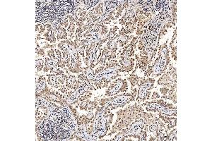 IHC analysis of SAE1 using anti-SAE1 antibody (ABIN7601346). (SAE1 anticorps  (AA 33-299))