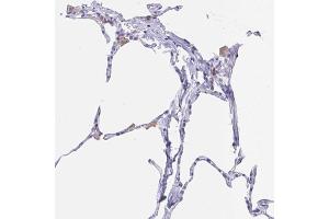 Immunohistochemical staining (Formalin-fixed paraffin-embedded sections) of human lung with FCGR3A polyclonal antibody  shows positivity in macrophages. (FCGR3A anticorps  (AA 227-254))