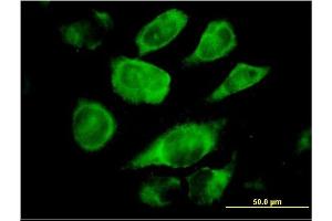 Immunofluorescence of monoclonal antibody to SSR4 on HeLa cell.