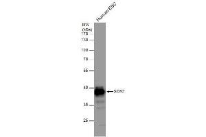 Western Blotting (WB) image for anti-SRY (Sex Determining Region Y)-Box 2 (SOX2) antibody (ABIN2855074)