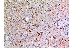 Immunohistochemistry (IHC) analysis of paraffin-embedded Human Liver, antibody was diluted at 1:100. (CYBB anticorps  (Internal Region))