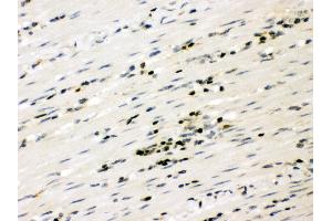 Anti- RUNX3 Picoband antibody, IHC(P) IHC(P): Human Intestinal Cancer Tissue