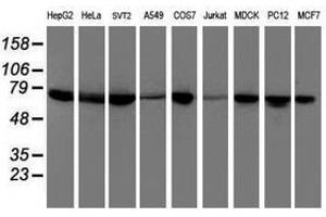 Image no. 2 for anti-Dystrobrevin, beta (DTNB) antibody (ABIN1497915)