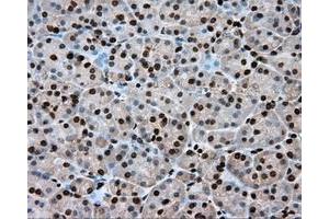 Immunohistochemical staining of paraffin-embedded Kidney tissue using anti-ERCC1 mouse monoclonal antibody. (ERCC1 anticorps)