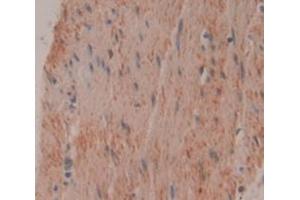 IHC-P analysis of Human Tissue, with DAB staining. (TNNI1 anticorps  (AA 1-187))