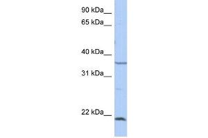 WB Suggested Anti-SPRY2 Antibody Titration: 0.