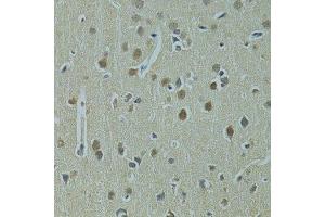 Immunohistochemistry of paraffin-embedded rat brain using UBE2I antibody.