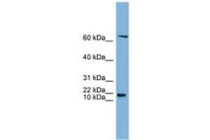 Image no. 1 for anti-GM2 Ganglioside Activator (GM2A) (N-Term) antibody (ABIN6743402) (GM2A anticorps  (N-Term))