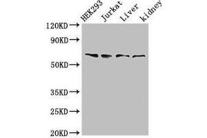 Western Blot Positive WB detected in: HEK293 whole cell lysate, Jurkat whole cell lysate, Rat liver tissue, Rat kidney tissue All lanes: TXK antibody at 3 μg/mL Secondary Goat polyclonal to rabbit IgG at 1/50000 dilution Predicted band size: 62 kDa Observed band size: 62 kDa