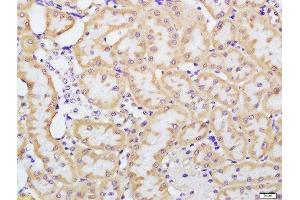Paraformaldehyde-fixed, paraffin embedded rat kidney tissue, Antigen retrieval by boiling in sodium citrate buffer(pH6) for 15min, Block endogenous peroxidase by 3% hydrogen peroxide for 30 minutes, Blocking buffer (normal goat serum) at 37°C for 20min, Antibody incubation with Rabbit Anti-beta defensin 1 Polyclonal Antibody, Unconjugated  at 1:200 overnight at 4°C, followed by a conjugated secondary and DAB staining