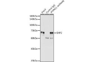 Immunoprecipitation analysis of 300 μg extracts of MCF7 cells using 3 μg SHP2 antibody (ABIN6131893, ABIN6146440, ABIN6146441 and ABIN7101402).