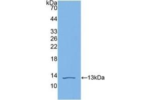 Detection of Recombinant C4b, Human using Polyclonal Antibody to Complement C4-B (C4B)