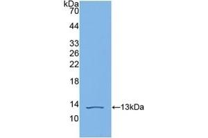 Detection of Recombinant C4b, Human using Polyclonal Antibody to Complement C4-B (C4B) (C4B anticorps  (AA 680-756))