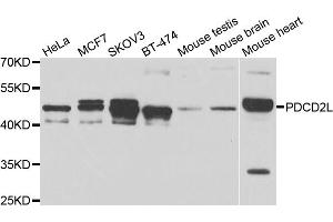 Western blot analysis of extracts of various cell lines, using PDCD2L antibody. (PDCD2L anticorps)
