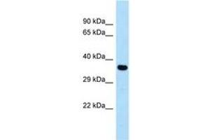 Image no. 1 for anti-Cysteinyl Leukotriene Receptor 1 (CYSLTR1) (AA 199-248) antibody (ABIN6747993) (CysLTR1 anticorps  (AA 199-248))
