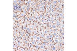 Immunohistochemistry of paraffin-embedded mouse liver using  antibody (ABIN6129926, ABIN6136997, ABIN6136998 and ABIN6218500) at dilution of 1:100 (40x lens). (APOA1 anticorps  (AA 25-267))