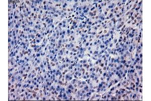 Immunohistochemistry (IHC) image for anti-Epithelial Cell Adhesion Molecule (EPCAM) (AA 24-265) antibody (ABIN1491254) (EpCAM anticorps  (AA 24-265))