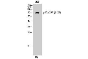Western Blotting (WB) image for anti-Cell Division Cycle 25 Homolog A (S. Pombe) (CDC25A) (pSer124) antibody (ABIN3179540) (CDC25A anticorps  (pSer124))