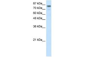 SMARCA3 antibody (20R-1090) used at 0. (HLTF anticorps  (N-Term))