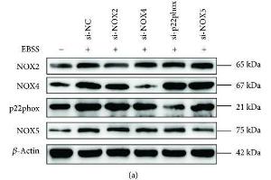NOX4, p22phox, and NOX5 modulate loss of calcium homeostasis and ER stress in ARPE-19 cells. (CYBB anticorps  (AA 283-570))