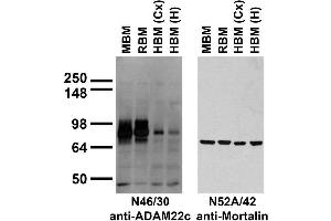 anti-ADAM Metallopeptidase Domain 22 (ADAM22) (AA 757-857), (Cytosolic) antibody