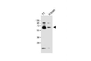 All lanes : Anti-DLL3 Antibody (C-term) at 1:1000 dilution Lane 1: TT whole cell lysate Lane 2: Human brain lysate Lysates/proteins at 20 μg per lane.