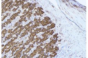 ABIN6277429 at 1/100 staining Human gastric tissue by IHC-P. (Peroxiredoxin 3 anticorps  (Internal Region))