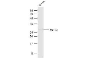 Mouse uterus lysates probed with TMEPAI Polyclonal Antibody, Unconjugated  at 1:300 dilution and 4˚C overnight incubation. (PMEPA1 anticorps  (AA 21-120))