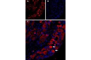 Expression of TRPV1 in rat DRGs - Immunohistochemical staining of TRPV1 in rat dorsal root ganglion (DRG) using Guinea pig Anti-TRPV1 (VR1) Antibody (ABIN7043840, ABIN7045432 and ABIN7045433), (1:200). (TRPV1 anticorps  (C-Term, Intracellular))