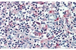 Detection of MARCO in Human Thymus Tissue using Polyclonal Antibody to Macrophage Receptor With Collagenous Structure (MARCO)