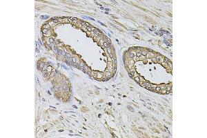 Immunohistochemistry of paraffin-embedded human prostate using S100A12 antibody. (S100A12 anticorps)