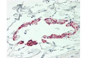 Human Small Intestine, Lymphatic Channel: Formalin-Fixed, Paraffin-Embedded (FFPE). (CCL21 anticorps  (AA 24-134) (Biotin))