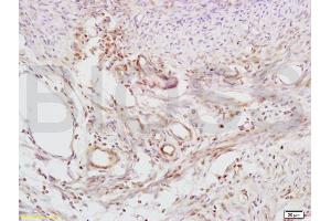 Formalin-fixed and paraffin embedded mouse uterus tissue labeled with Anti-Defensin-beta2/DEFB2/HBD-2 Polyclonal Antibody, Unconjugated (ABIN674574) at 1:200 followed by conjugation to the secondary antibody and DAB staining