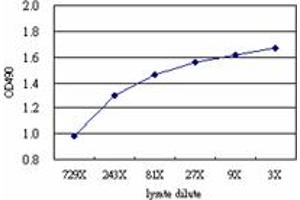 ACY1 (Human) Matched Antibody Pair