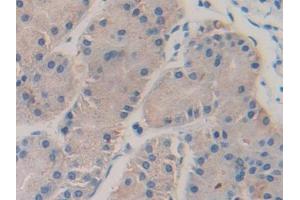 DAB staining on IHC-P; Samples: Human Stomach Tissue (Coagulation Factor V anticorps  (AA 1979-2217))
