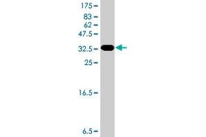 Western Blot detection against Immunogen (31.
