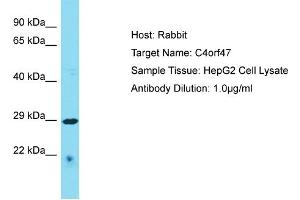 Host: Rabbit Target Name: C4orf47 Sample Type: HepG2 Whole Cell lysates Antibody Dilution: 1. (C4ORF47 anticorps  (C-Term))