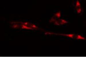 anti-Cyclin-Dependent Kinase 15 (ALS2CR7) (Internal Region) antibody
