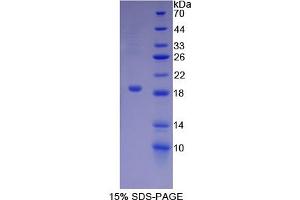 SDS-PAGE of Protein Standard from the Kit (Highly purified E. (Biglycan Kit ELISA)