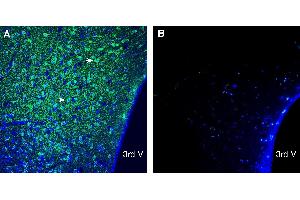 Expression of CD63 in aged mouse (18 months) hypothalamus.