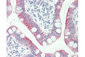 Anti-SLC41A1 antibody IHC staining of human small intestine.