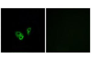 Immunofluorescence analysis of A549 cells, using CNGA2 antibody. (CNGA2 anticorps  (Internal Region))