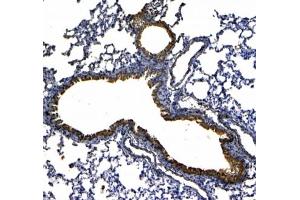 IHC testing of FFPE rat lung tissue with Uteroglobin antibody at 1ug/ml. (SCGB1A1 anticorps)